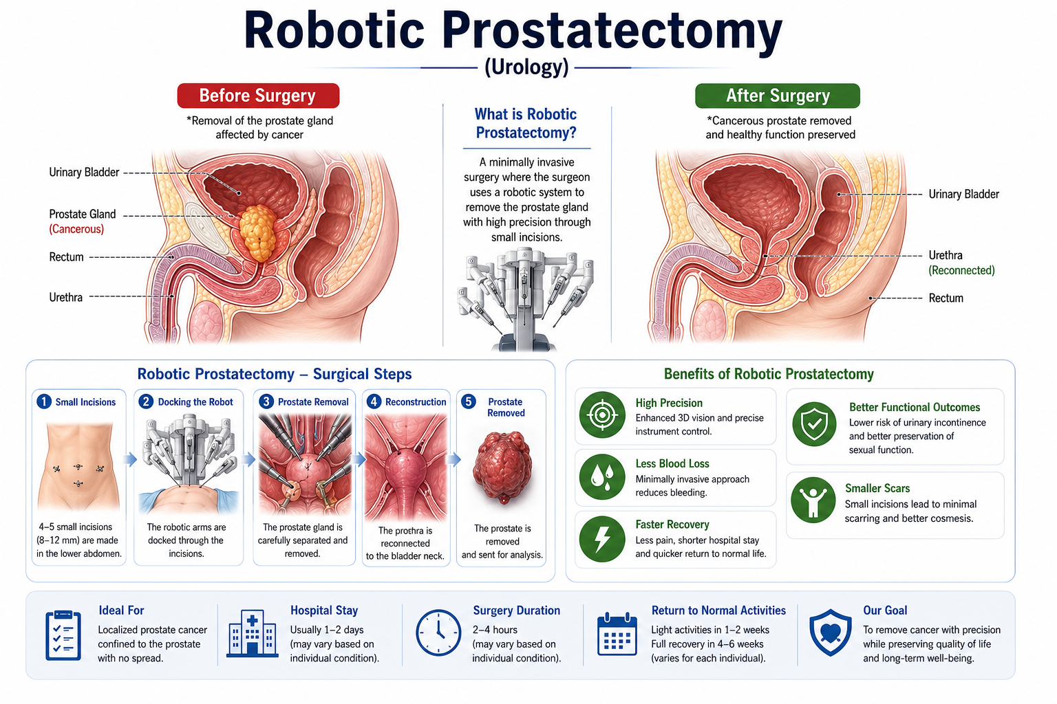 Robotic Prostatectomy — anatomy diagram